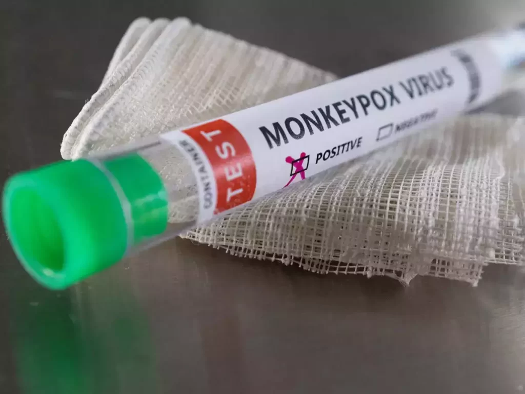 Monkeypox, India Monkeypox case, India, Monkeypox virus, delhi, મંકીપોક્સ, ભારતમાં મંકીપોક્સ, 